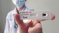 Novo coronavírus: Primeira etapa de testes da Câmara de Goiânia identifica 17 casos ativos de Covid-19